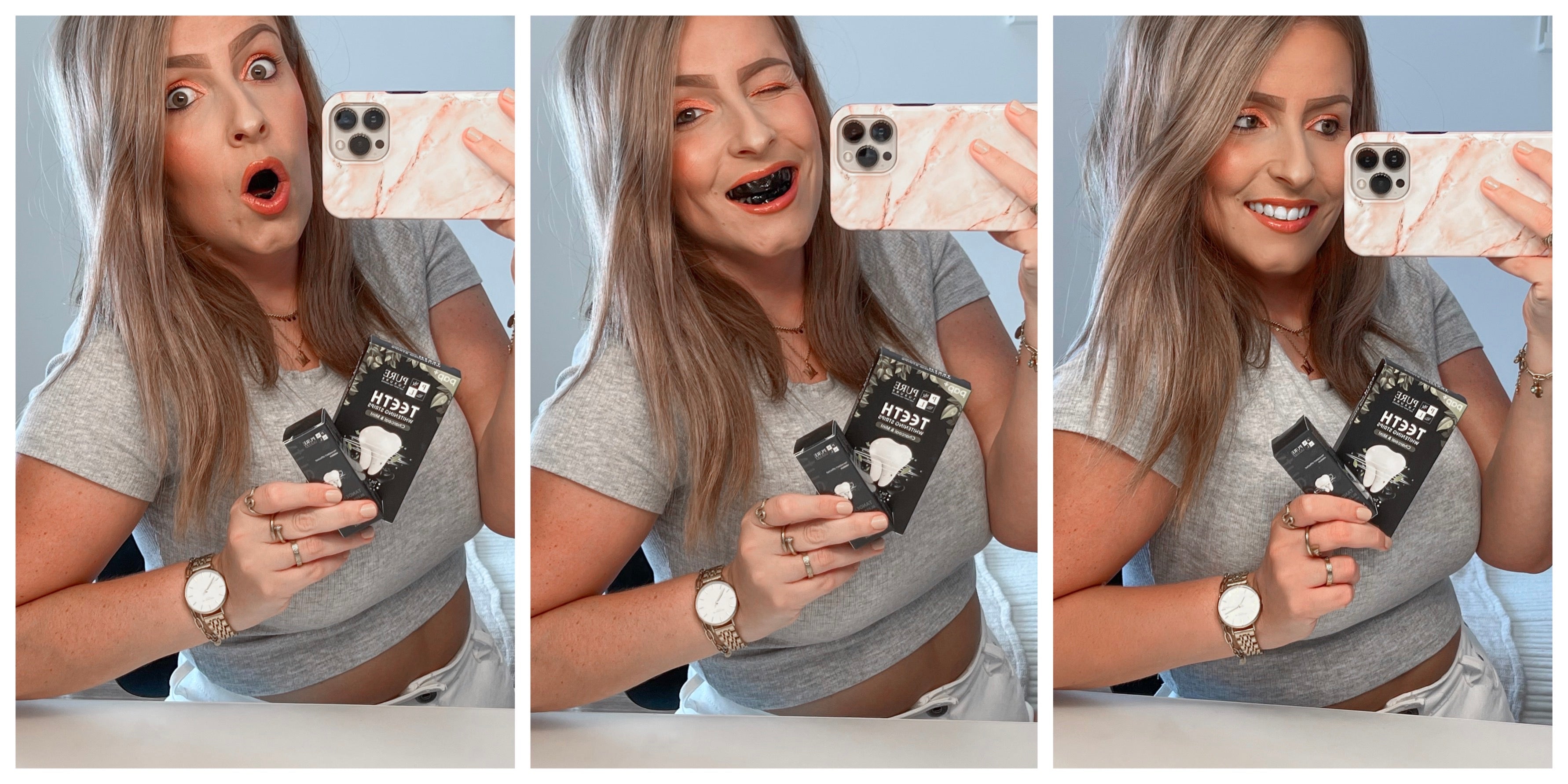 Waarom willen mensen witte tanden? Het Verlangen naar een Stralende Glimlach!