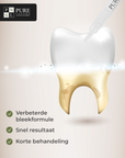 voordelen vulgel tandenbleker