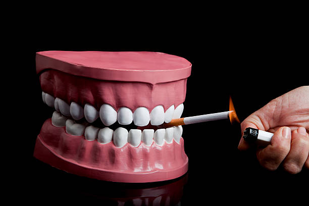 Hoe Tandenbleken Kan Helpen Bij Verkleuring door Roken met Pureluxure-whitening!