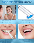 Teeth Whitening Pen - 2ML